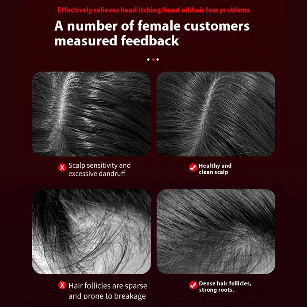 3-in-1 Electric Scalp Massage Comb – Red Light Therapy & Oil Applicator for Hair Growth - GUMARIE WELLNESS