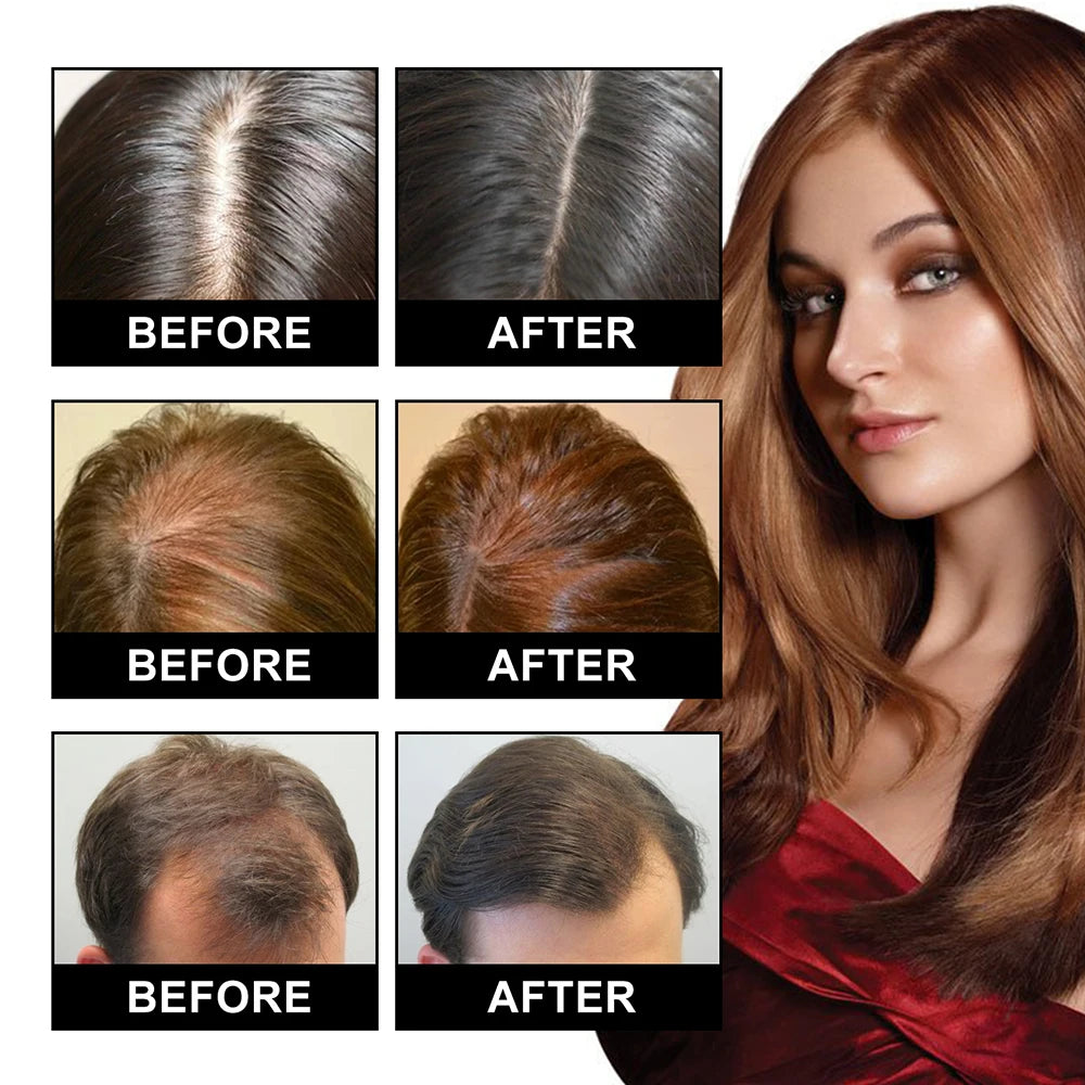 3-in-1 Electric Scalp Massage Comb – Red Light Therapy & Oil Applicator for Hair Growth - GUMARIE WELLNESS